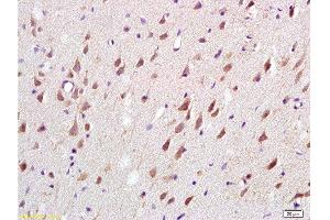 Formalin-fixed and paraffin embedded: rat brain tissue labeled with Anti-MAG-a/L-MAG Polyclonal Antibody , Unconjugated at 1:200, followed by conjugation to the secondary antibody and DAB staining (MAG anticorps  (AA 551-626))