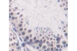 IHC-P analysis of Human Tissue, with DAB staining. (ube3a anticorps  (AA 158-407))