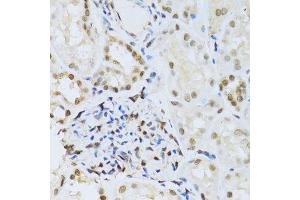 Immunohistochemistry of paraffin-embedded human kidney using MAPK3 Antibody.
