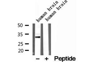 Western blot analysis of extracts of human brain tissue, using CAPZA1 antibody.