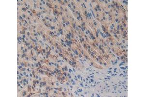 IHC-P analysis of Kidney tissue, with DAB staining. (DOK7 anticorps  (AA 63-320))