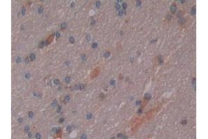 IHC-P analysis of Human Cerebrum Tissue, with DAB staining. (Osteopontin anticorps  (AA 18-314))