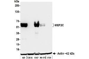 Western Blotting (WB) image for anti-Myocyte Enhancer Factor 2C (MEF2C) (AA 425-475) antibody (ABIN7795747) (Recombinant MEF2C anticorps  (AA 425-475))
