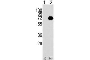 Western blot analysis of ACOX1 antibody and 293 cell lysate either nontransfected (Lane 1) or transiently transfected with the ACOX1 gene (2).