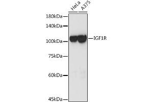 Western blot analysis of extracts of various cell lines, using IGF1R antibody (ABIN3020767, ABIN3020768, ABIN3020769 and ABIN6213714) at 1:3000 dilution. (IGF1R anticorps  (AA 660-760))