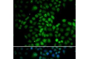 Immunofluorescence analysis of HeLa cells using C11orf30 Polyclonal Antibody (EMSY anticorps)