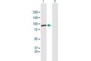 Western Blot analysis of CALD1 expression in transfected 293T cell line by CALD1 MaxPab polyclonal antibody. (Caldesmon anticorps  (AA 1-538))