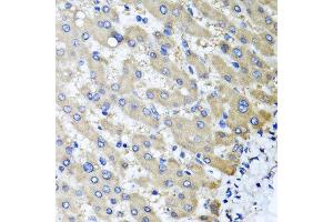Immunohistochemistry of paraffin-embedded human liver injury using RBP2 antibody at dilution of 1:100 (x40 lens). (RBP2 anticorps)