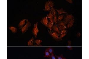 Immunofluorescence analysis of U-2 OS cells using BAP1 Polyclonal Antibody at dilution of 1:100 (40x lens).