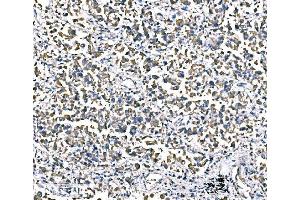 IHC analysis of ATG16L1 using anti-ATG16L1 antibody (ABIN7602244). (ATG16L1 anticorps  (AA 66-359))