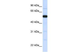 WB Suggested Anti-THUMPD2 Antibody Titration:  0. (THUMPD2 anticorps  (N-Term))