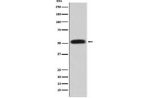 Western blot analysis of Glycerol kinase expression in HepG2 cell lysate.