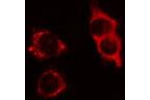 ABIN6274412 staining LOVO cells by IF/ICC. (ATPBD3 anticorps  (C-Term))
