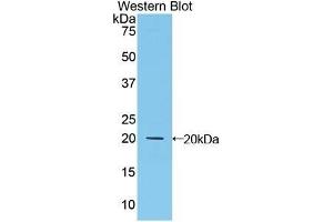 Detection of Recombinant MFAP5, Human using Polyclonal Antibody to Microfibrillar Associated Protein 5 (MFAP5)