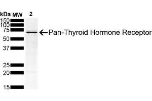 Western Blot analysis of Human Hep G2 Hepatoblastoma Cell lysate showing detection of Thyroid Hormone Receptor protein using Mouse Anti-Thyroid Hormone Receptor Monoclonal Antibody, Clone H43 (ABIN6952041).