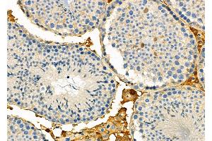 ABIN6257643 and ABIN6274758 at 1/100 staining Mouse testis tissue by IHC-P. (RPS5 anticorps  (Internal Region))