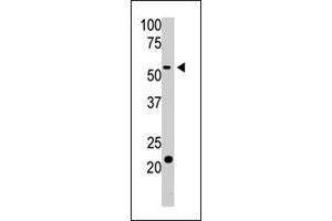 The BACE2 polyclonal antibody  is used in Western blot to detect BACE2 in HL-60 cell lysate.