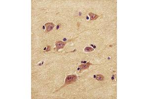 (ABIN1882188 and ABIN2839165) staining UCHL1 in human brain tissue sections by Immunohistochemistry (IHC-P - paraformaldehyde-fixed, paraffin-embedded sections).