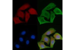 ABIN6264151 and ABIN6279649 staining Hela cells by IF/ICC. (PEX5 anticorps  (Internal Region))