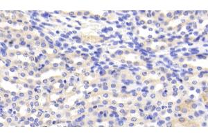 Detection of CAT in Mouse Kidney Tissue using Polyclonal Antibody to Catalase (CAT)