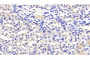Detection of CAT in Mouse Kidney Tissue using Polyclonal Antibody to Catalase (CAT) (Catalase anticorps  (AA 80-239))