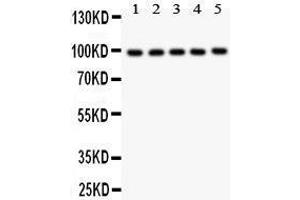 Anti- HCN1 antibody, Western blotting All lanes: Anti HCN1  at 0.