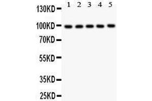 Anti- HCN1 antibody, Western blotting All lanes: Anti HCN1  at 0. (HCN1 anticorps  (AA 618-890))