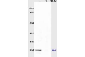 Lane 1: mouse live lysates Lane 2: mouse embryo lysates probed with Anti AVPR2 Polyclonal Antibody, Unconjugated (ABIN733478) at 1:200 in 4 °C. (Deoxyuridine Triphosphatase (DUT) (AA 151-252) anticorps)