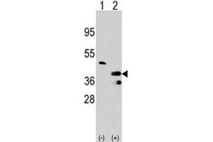 Western blot analysis of PRMT1 antibody and 293 cell lysate either nontransfected (Lane 1) or transiently transfected with the PRMT1 gene (2). (PRMT1 anticorps  (AA 316-347))
