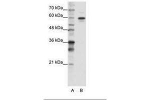 Image no. 3 for anti-Heterogeneous Nuclear Ribonucleoprotein L-Like (HNRPLL) (AA 24-73) antibody (ABIN202737) (HNRPLL anticorps  (AA 24-73))
