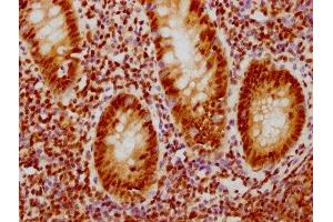 IHC image of ABIN7127416 diluted at 1:126.