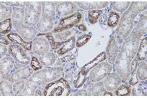 Immunohistochemistry of paraffin-embedded Mouse kidney using ITGAV Polyclonal Antibody at dilution of 1:50 (40x lens). (CD51 anticorps)