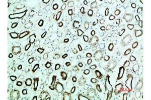 Immunohistochemical analysis of paraffin-embedded human-kidney, antibody was diluted at 1:200