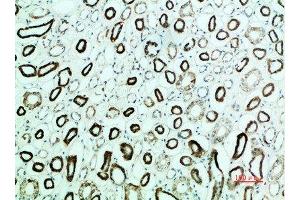 Immunohistochemical analysis of paraffin-embedded human-kidney, antibody was diluted at 1:200 (PTH1R anticorps  (AA 1268-1341))