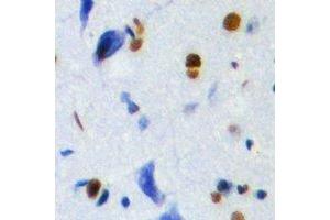 Immunohistochemistry (IHC) image for anti-Thymopoietin (TMPO) antibody (ABIN7308420)