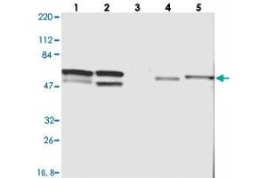 Western blot analysis of Lane 1: RT-4, Lane 2: U-251 MG, Lane 3: Human Plasma, Lane 4: Liver, Lane 5: Tonsil with CDCA7 polyclonal antibody  at 1:250-1:500 dilution. (CDCA7 anticorps)