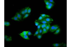 Immunofluorescence staining of HepG2 cells with ABIN7142464 at 1:100, counter-stained with DAPI. (HOGA1 anticorps  (AA 1-164))