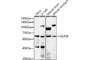 Western blot analysis of extracts of various cell lines, using GLP2R antibody (ABIN6127974, ABIN6141141, ABIN6141142 and ABIN6222287) at 1:500 dilution. (GLP2R anticorps  (AA 1-180))