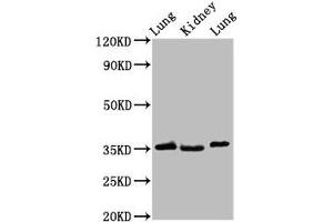 Western Blot Positive WB detected in: Rat lung tissue, Rat kidney tissue, Mouse lung tissue All lanes: HOXD1 antibody at 2.