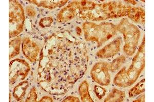 Immunohistochemistry of paraffin-embedded human kidney tissue using ABIN7160805 at dilution of 1:100 (SLC9A3R2 anticorps  (AA 106-313))
