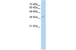 WB Suggested Anti-GHRHR Antibody Titration:  0. (GHRHR anticorps  (C-Term))