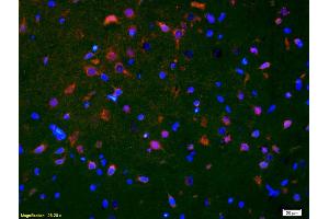 Formalin-fixed and paraffin-embedded rat brain labeled with Anti-Smoothened/SMO Polyclonal Antibody, Unconjugated (ABIN680908) 1:200, overnight at 4°C, The secondary antibody was Goat Anti-Rabbit IgG, Cy3 conjugated used at 1:200 dilution for 40 minutes at 37°C. (SMO anticorps  (AA 551-650))