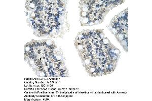 Rabbit Anti-GIPC2 Antibody  Paraffin Embedded Tissue: Human Intestine Cellular Data: Epithelial cells of intestinal villas Antibody Concentration: 4. (GIPC2 anticorps  (N-Term))