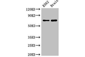 Western Blot Positive WB detected in: K562 whole cell lysate, Mouse brain tissue All lanes: SLU7 antibody at 3 μg/mL Secondary Goat polyclonal to rabbit IgG at 1/50000 dilution Predicted band size: 69 kDa Observed band size: 69 kDa (SLU7 anticorps  (AA 138-310))