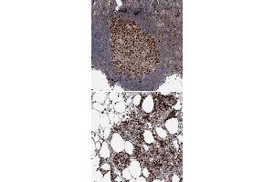 Immunohistochemical staining of human bone marrow with KIF4A polyclonal antibody  shows strong nuclear positivity in hematopoietic cells at 1:200-1:500 dilution. (KIF4A anticorps)