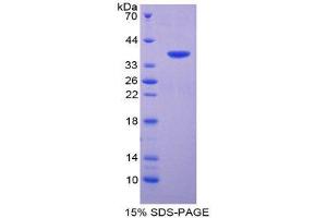 SDS-PAGE (SDS) image for Kininogen 1 (KNG1) (AA 367-430) protein (His tag,GST tag) (ABIN1981222)