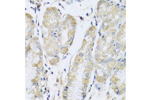 Immunohistochemistry of paraffin-embedded human stomach using FANCA antibody (ABIN5975159) at dilution of 1/100 (40x lens). (FANCA anticorps)