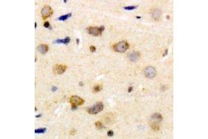 Immunohistochemical analysis of Caldesmon (pS789) staining in human brain formalin fixed paraffin embedded tissue section.