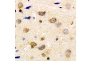 Immunohistochemical analysis of Caldesmon (pS789) staining in human brain formalin fixed paraffin embedded tissue section. (Caldesmon anticorps  (C-Term, pSer789))
