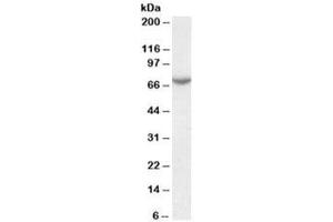 Western blot testing of human placenta lysate with Arylsulfatase C antibody at 0. (STS anticorps)